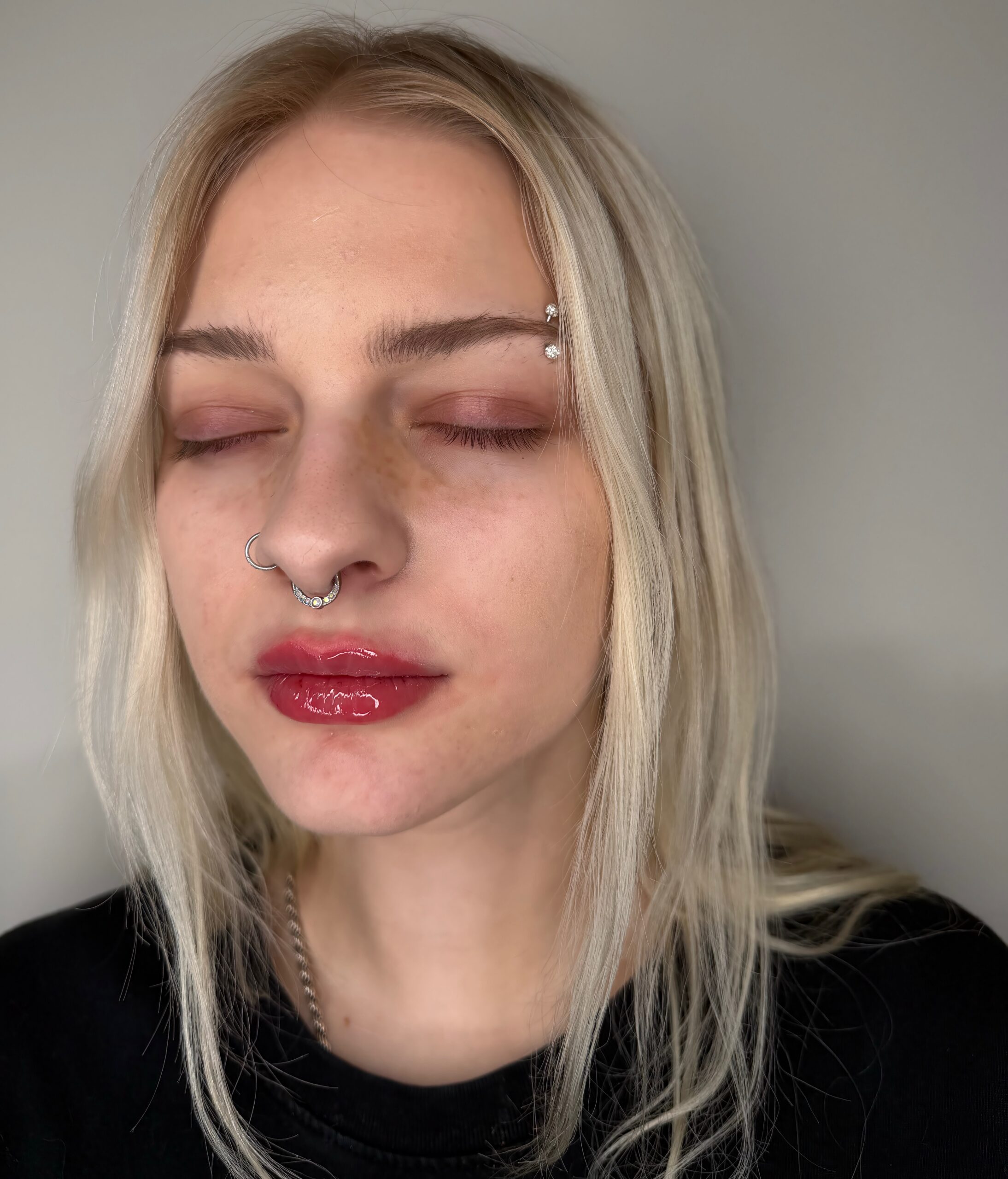 Lip filler at Aesthetic Beauty Lab Apple Valley MN