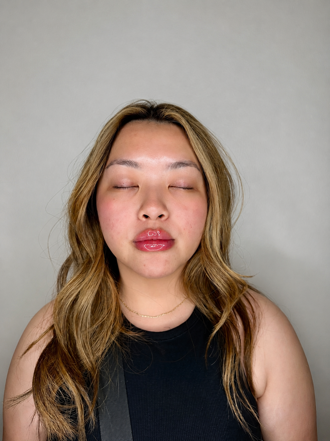 Lip filler at Aesthetic Beauty Lab Apple Valley MN