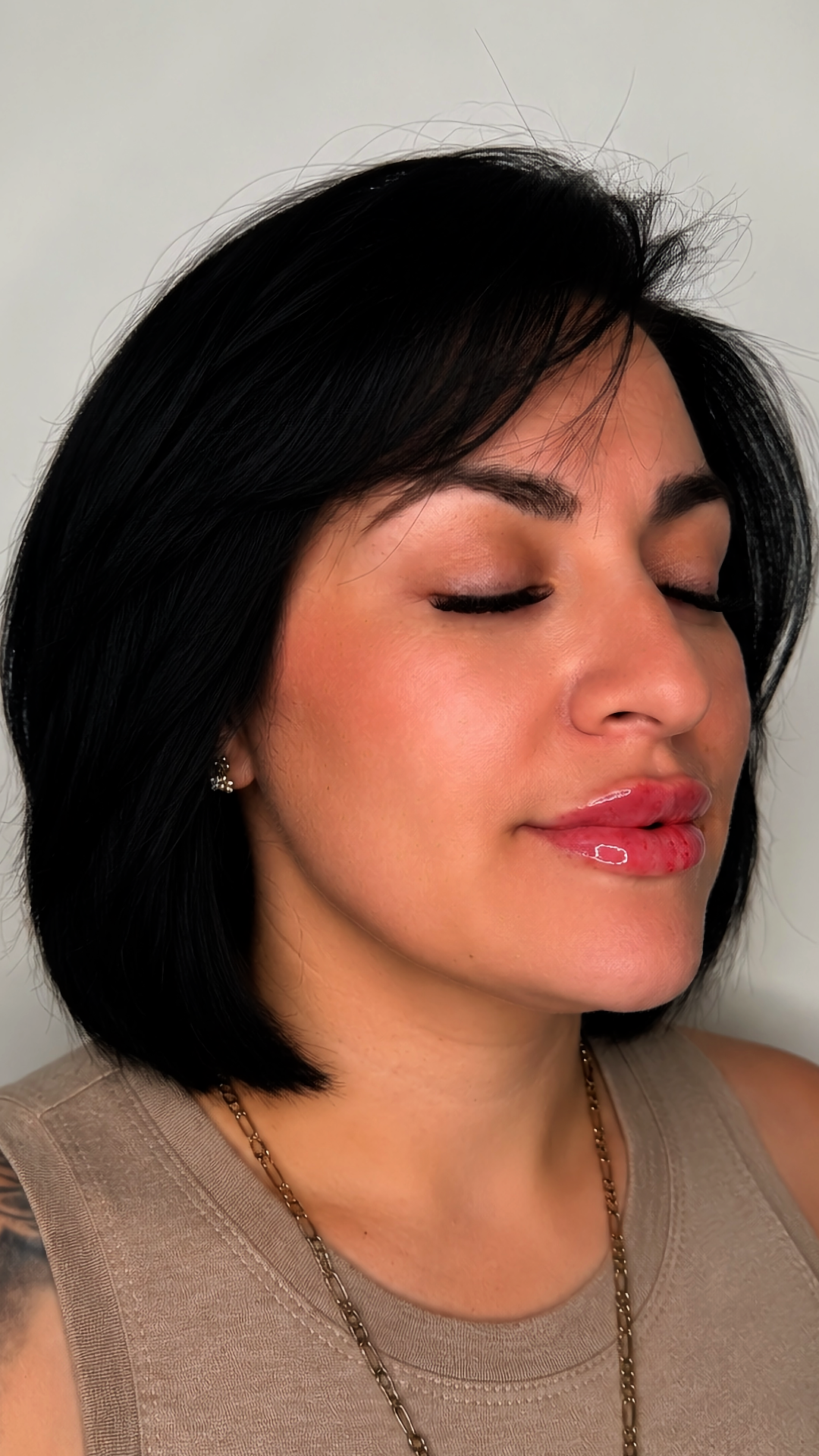 Lip filler at Aesthetic Beauty Lab Apple Valley MN