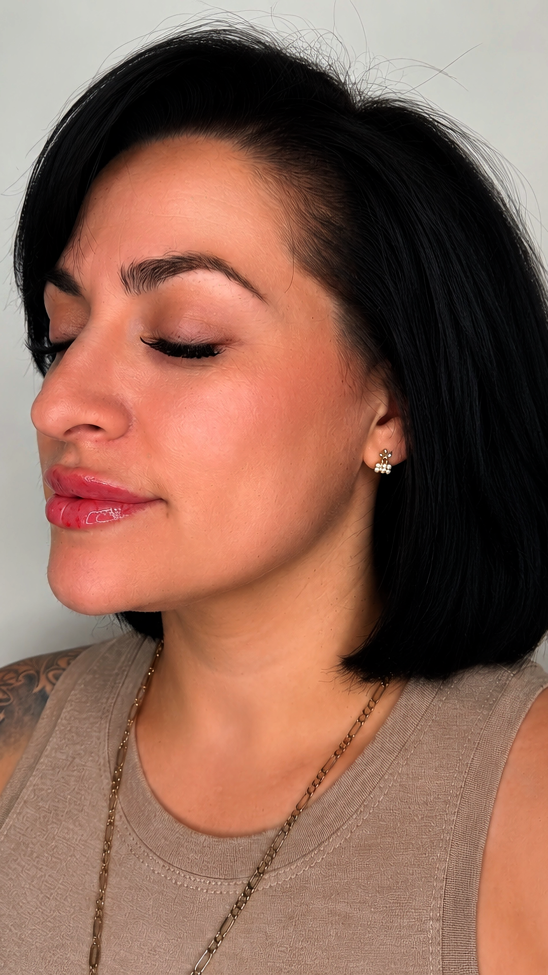 Lip filler at Aesthetic Beauty Lab Apple Valley MN