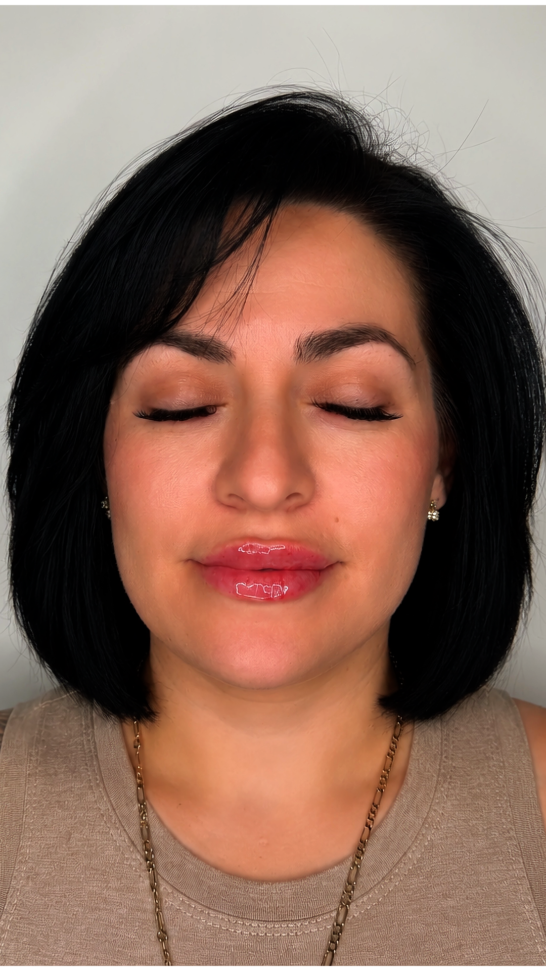 Lip filler at Aesthetic Beauty Lab Apple Valley MN