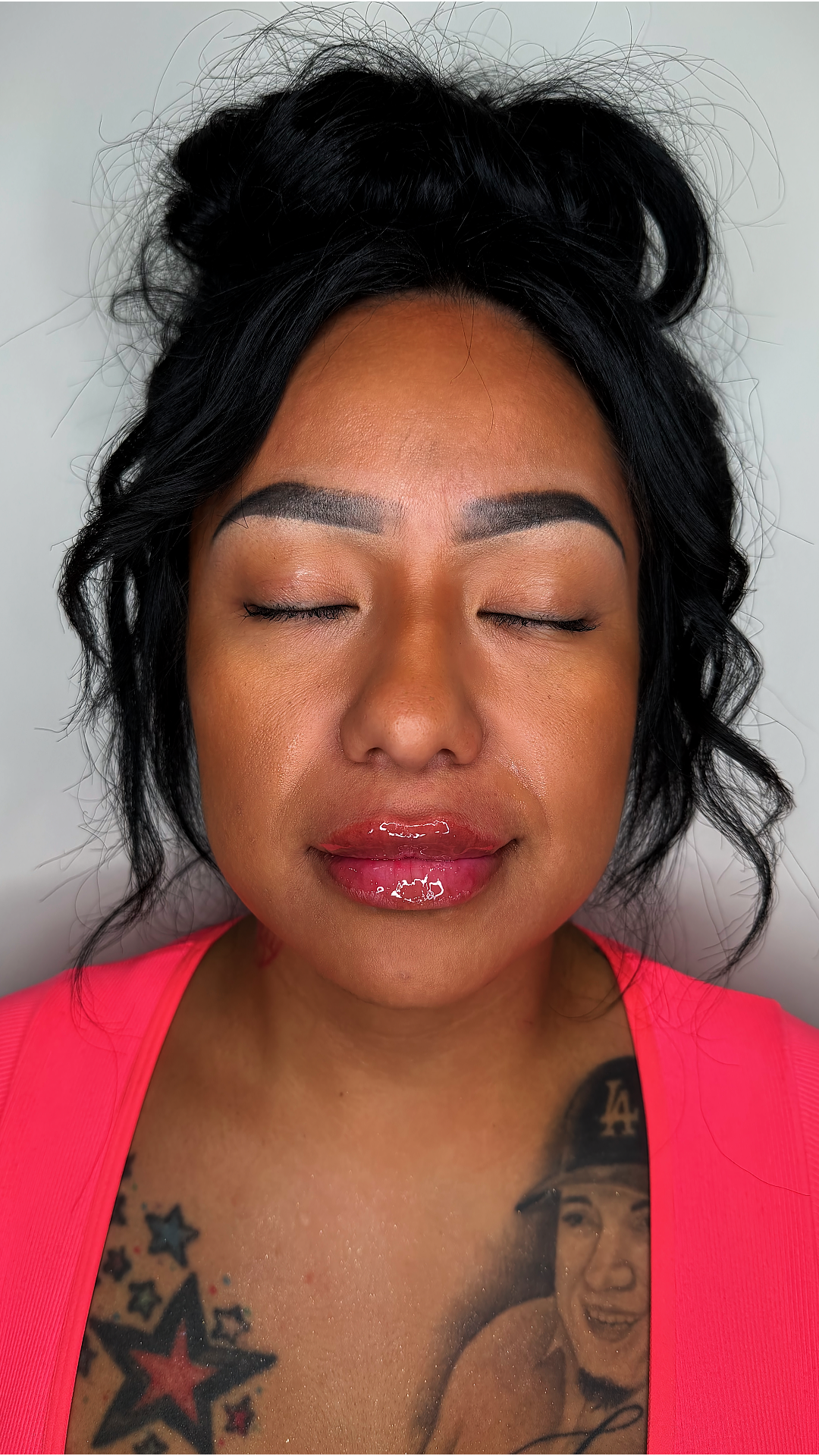 Lip filler at Aesthetic Beauty Lab Apple Valley MN