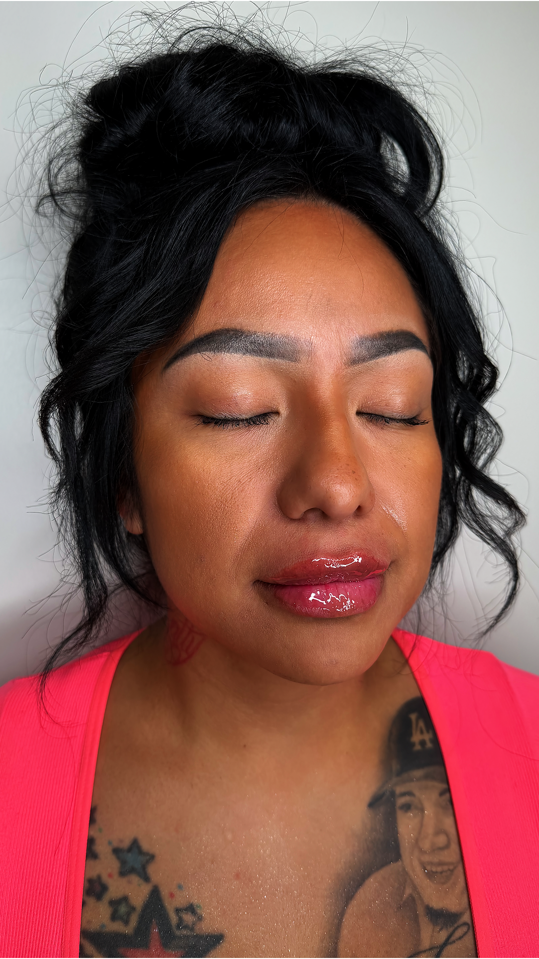 Lip filler at Aesthetic Beauty Lab Apple Valley MN
