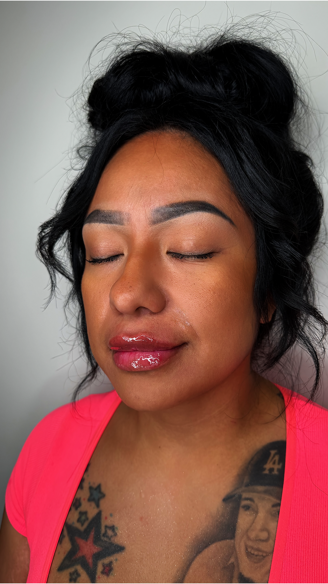 Lip filler at Aesthetic Beauty Lab Apple Valley MN